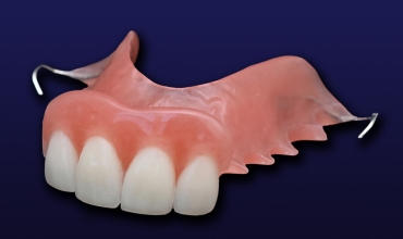 Acrylic Partial Denture Clinic in Greater Noida