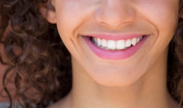 Cosmetic  Aesthetic Dentistry Clinic in Greater Noida