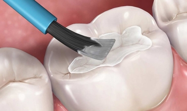 Cosmetic Filling Clinic in Greater Noida