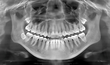 Dental X-Ray Clinic in Greater Noida
