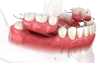 Fixed Prosthodontics Clinic in Greater Noida