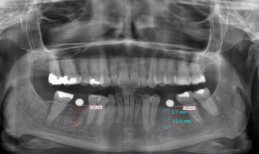 OPG Clinic in Greater Noida