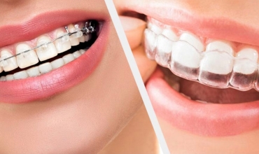 Orthodontic Treatment Clinic in Greater Noida